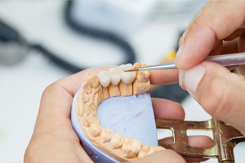 Person applying dental implants with precision tools.