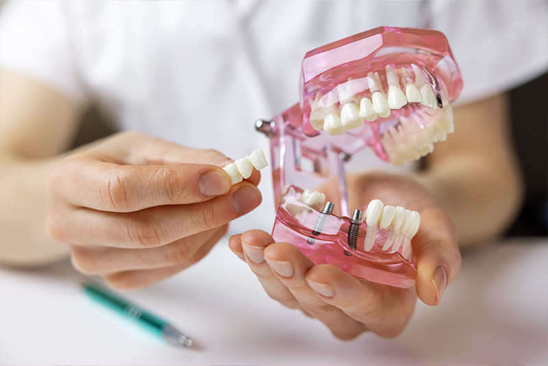 A person is holding a transparent model of a human mouth, showing the teeth and gums.