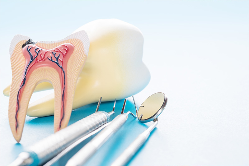 Dental model with toothpick, dental instruments, and anatomical tooth illustration.