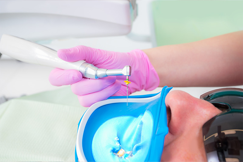 A dental hygienist using an ultrasonic scaler to clean a patient s teeth.