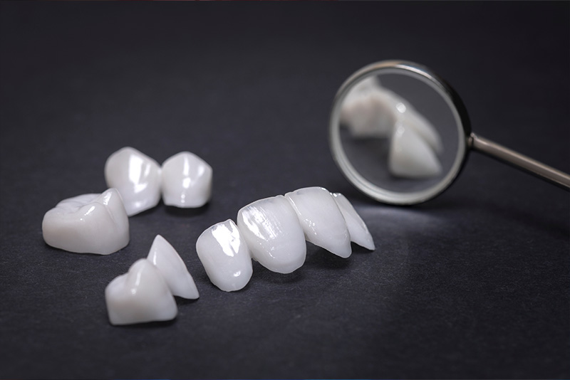 The image displays a collection of white dental implants on a dark background, with a magnifying glass to the right, suggesting an examination or close-up view.