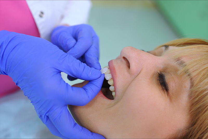 A dental professional using a tool to perform a dental procedure on a patient.