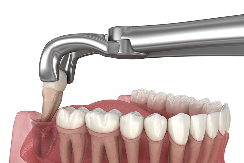 An illustration of a dental hygiene device, featuring a faucet-like handle and a small brush head with bristles inserted into a mouth model, simulating the act of cleaning teeth.