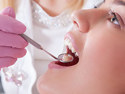 Sunlight Dental Group | Dental Fillings, Oral Cancer Screening and Extractions